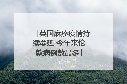 英国麻疹疫情持续蔓延 今年来伦敦病例数最多